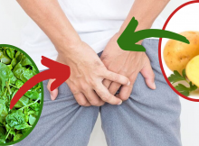 Como curar las hemorroides rapidamente